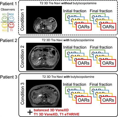 A pilot study on interobserver variability in organ-at-risk contours in magnetic resonance imaging-guided online adaptive radiotherapy for pancreatic cancer